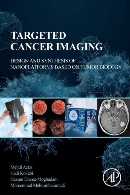 Mehrmohammadi Mohammad (Assistant Professor Of Biomedical/ Electrical And Computer Engineering Wayne State University Michigan Usa) - Targeted Cancer Imaging Design And Synthesis Of Nanoplatforms Based On Tumor Biology - Paperback