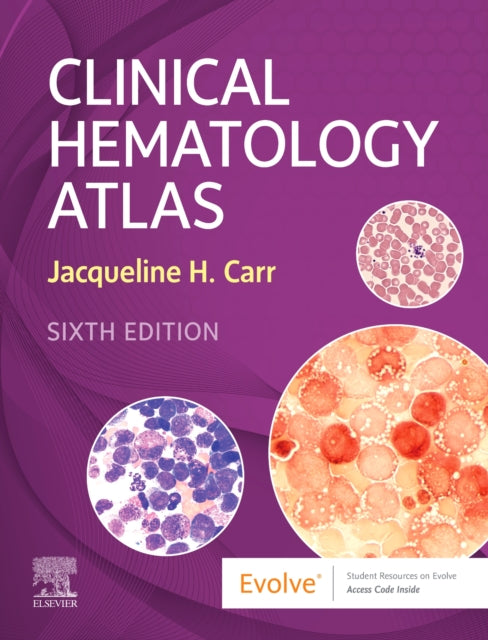 Binding: Educational And Professional
Description: Learn how to accurately identify cells at the microscope with Clinical Hematology Atlas 6th Edition.