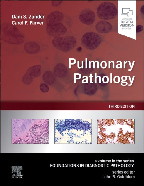 Binding: Hardcover
Description: Covering both common and rare neoplastic and nonneoplastic diseases of the lung and pleura Pulmonary Pathology 3rd Edition is an essential foundation text for pathologists.