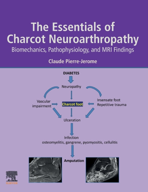 Binding: Paperback
Description: The Essential Charcot Neuroarthropathy: Biomechanics Pathophysiology and MRI Findings provides a comprehensive analysis of Charcot neuroarthropathy (or Charcot Foot) in diabetic patients.