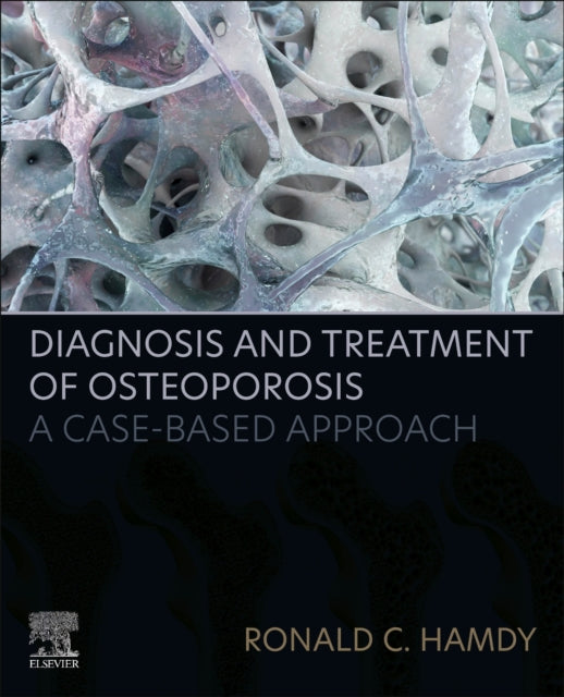Hamdy Ronald C. - Diagnosis And Treatment Of Osteoporosis A Case - Based Approach - Paperback