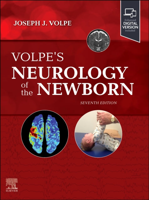 Binding: Hardcover
Description: Stay up to date with today's latest advances in diagnosis and management as well as the many scientific and technological advances that are revolutionizing neonatal neurology with the definitive text in the field.