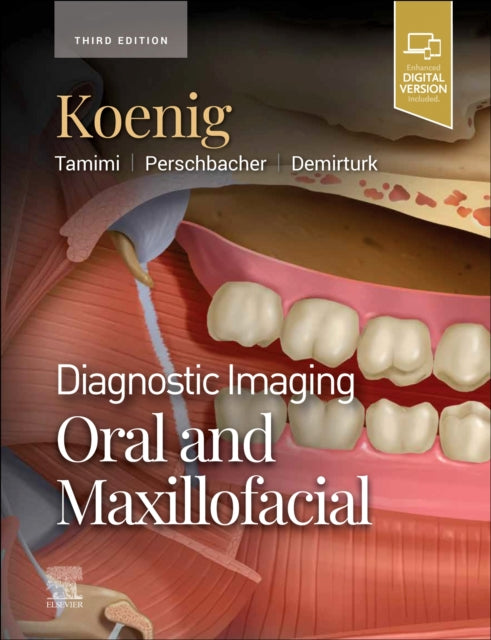 Demirturk Husniye Dds Ms Phd - Diagnostic Imaging: Oral And Maxillofacial - Hardcover