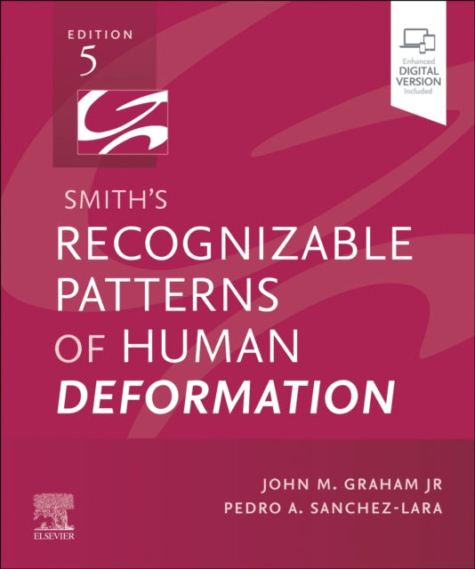 Sanchez - Lara Pedro A. Md. Msce - Smith's Recognizable Patterns Of Human Deformation - Paperback