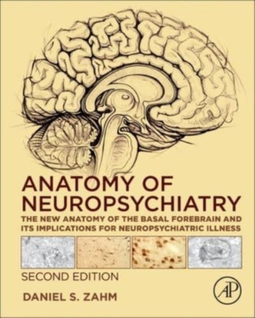 Binding: Hardcover
Title: Anatomy Of Neuropsychiatry The New Anatomy Of The Basal Forebrain And Its Implications For Neuropsychiatric Illness
Author(s): Zahm Daniel S. (Saint Louis University St.