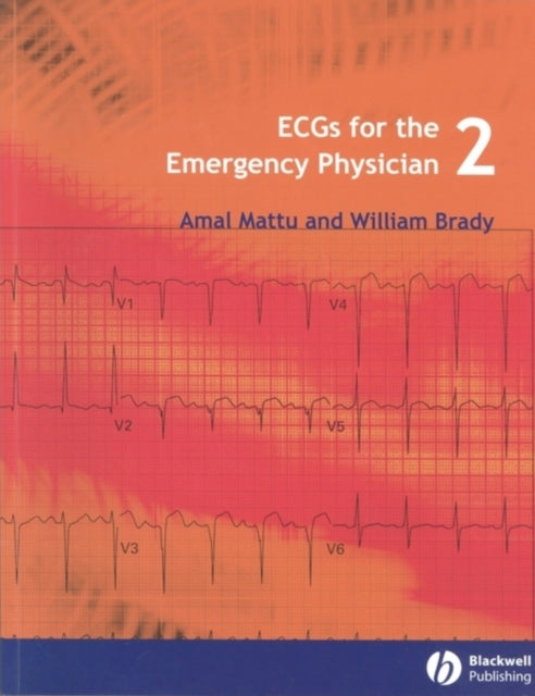 Brady William J. - Ecgs For The Emergency Physician 2 - Paperback