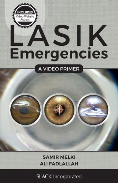 Binding: Paperback
Description: Femtosecond - assisted laser in - situ keratomileusis flaps have revolutionized refractive surgery since their introduction.