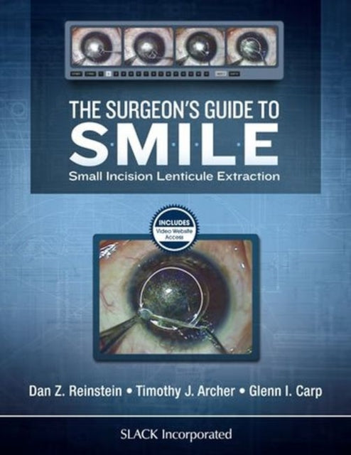 Binding: Hardcover
Description: Corneal refractive surgeons are likely already familiar with the theory behind small incision lenticule extraction (Smile) and the excellent postoperative outcomes it can achieve but they were left without a thorough and comprehensive guide to performing the procedure until now.