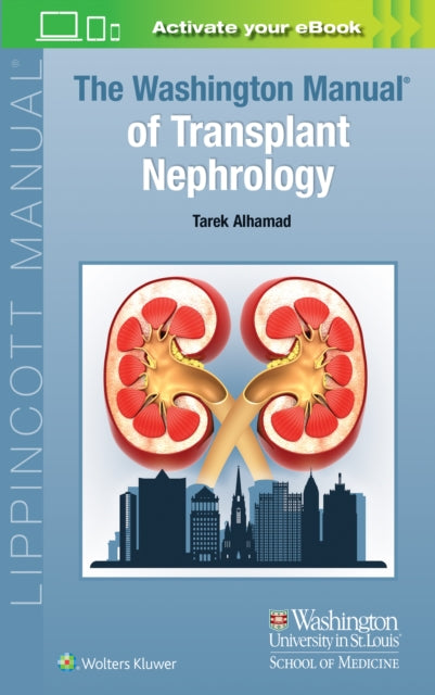 Alhamad Dr. Tarek Md - The Washington Manual Of Transplant Nephrology - Paperback