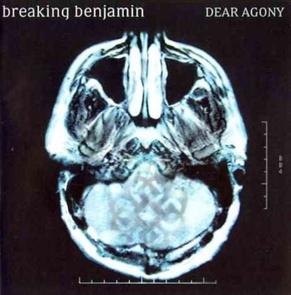 Dear Agony & Dark Before Dawn