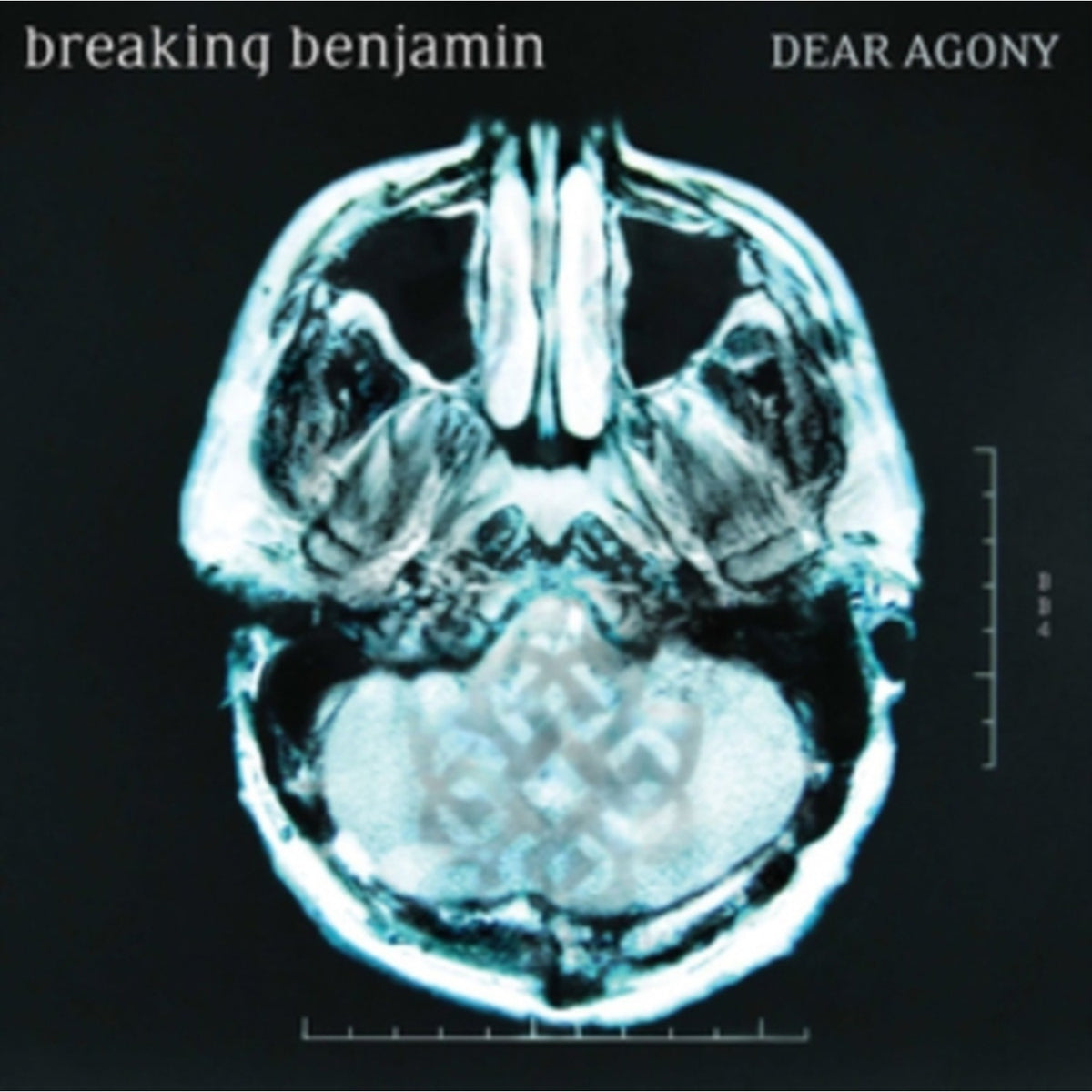 Dark Before Dawn & Dear Agony & Saturate