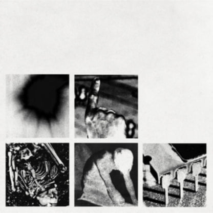 With Teeth (2LP) & Fragile (3LP/180G/2016 Remaster) & Bad Witch (LP)