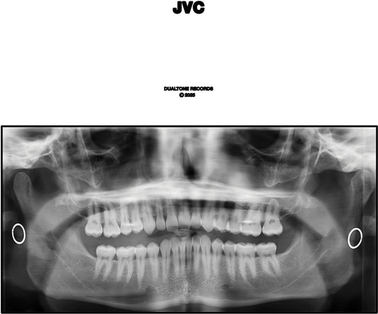 Jvc (2LP)