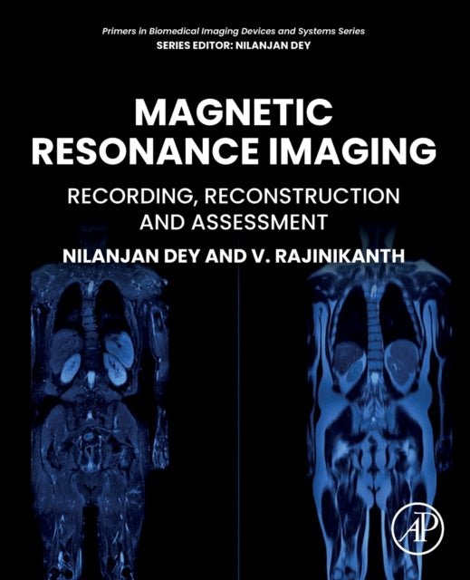 Binding: Paperback
Description: Magnetic Resonance Imaging: Recording Reconstruction and Assessment gives a detailed overview of magnetic resonance imaging (MRI) along with its applications and challenges.
