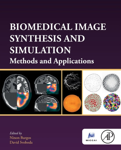 Binding: Paperback
Description: Biomedical Image Synthesis and Simulation: Methods and Applications presents the basic concepts and applications in image - based simulation and synthesis used in medical and biomedical imaging.