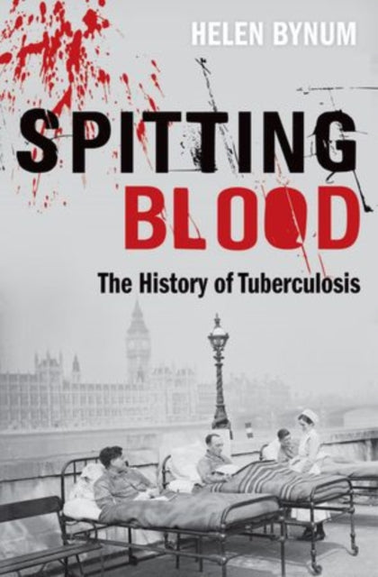 Binding: Paperback
Description: Tuberculosis is characterized as a social disease and few have been more inextricably linked with human history. There is evidence from the archaeological record that Mycobacterium tuberculosis and its human hosts have been together for a very long time.