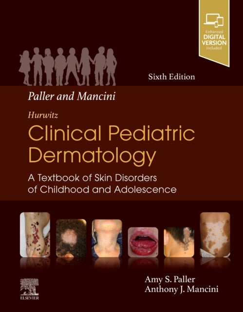 Binding: Hardcover
Description: Written by two leaders in the field of pediatric dermatology this classic text provides both detailed content for the specialist and easily accessible information for the non - dermatologist and less experienced clinician.