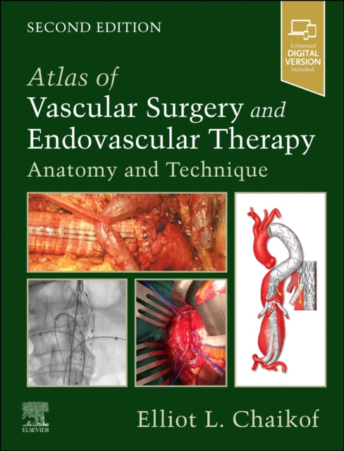 Binding: Hardcover
Description: Using a highly visual step - by - step approach Atlas of Vascular Surgery and Endovascular Therapy: Anatomy and Technique 2nd Edition is an easy - access comprehensive guide to the surgical treatment of diseases and disorders most often encountered by vascular surgeons.