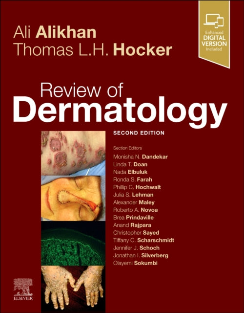 Binding: Paperback
Title: Review Of Dermatology
Author(s): Hocker Thomas L. H Md Mphil
Publisher: Elsevier - Health Sciences Division
Barcode: 9780323653862
Pages: 560 Pages
Publication Date: 5/23/2023
Category: Dermatology