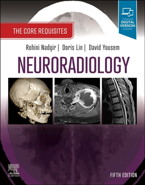 Binding: Paperback
Title: Neuroradiology The Core Requisites
Brand: Elsevier - Health Sciences Division
Barcode: 9780323759755
Pages: 576 Pages
Publication Date: 3/19/2024
Series: The Core Requisites
Category: Radiology