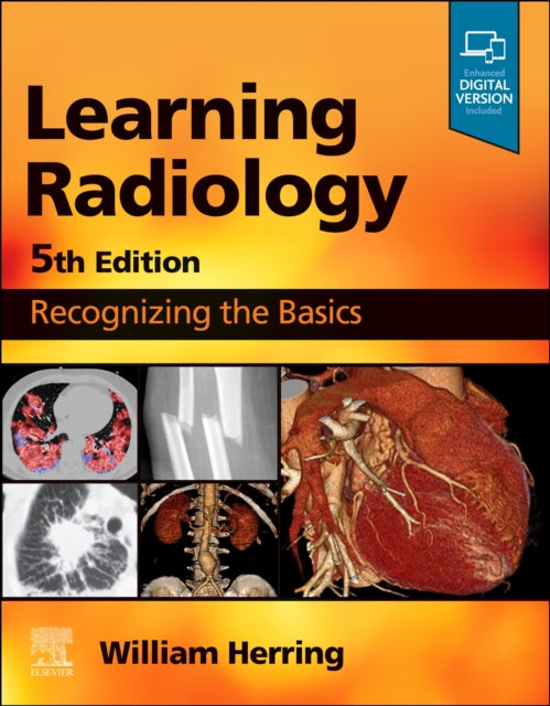 Binding: Paperback
Description: Dr. William Herring's Learning Radiology: Recognizing the Basics 5th Edition remains the leading introductory radiology text for medical students and others who are required to read and interpret common radiologic images.