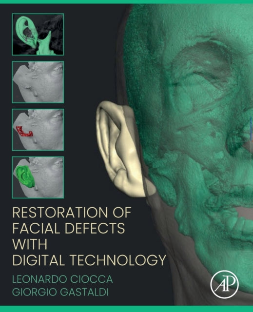 Binding: Paperback
Description: Restoration of Facial Defects with Digital Technology gives global descriptions of each method so that readers can project design and manufacture a maxillofacial prosthesis and customize maxillofacial surgery.
