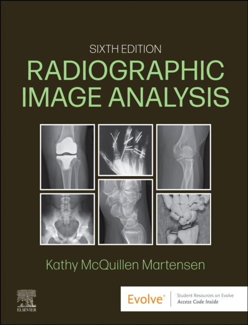 Martensen Kathy Mcquillen Ma Rt(R) (Director Of Radiologic Technology Education Department Of Radiology The University Of Iowa Hospitals And Clinics Iowa City Iowa) - Radiographic Image Analysis - Hardcover