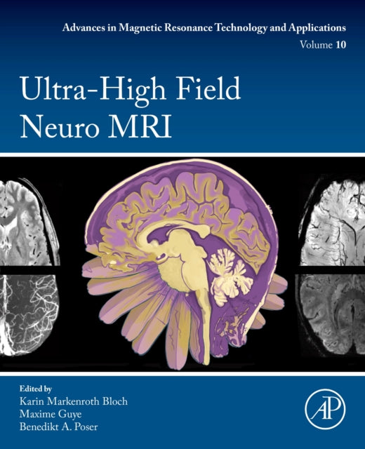 Binding: Paperback
Description: Ultra - High Field Neuro MRI is a comprehensive reference and educational resource on the current state of neuroimaging at ultra - high field (UHF) with an emphasis on 7 T.