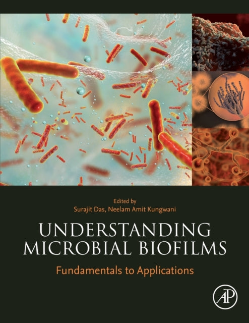 Binding: Paperback
Description: ** Selected for Doody's Core Titles 2024 in Microbiology** Understanding Microbial Biofilms: Fundamentals to Applications focuses on the microbial biofilms of different environments.
