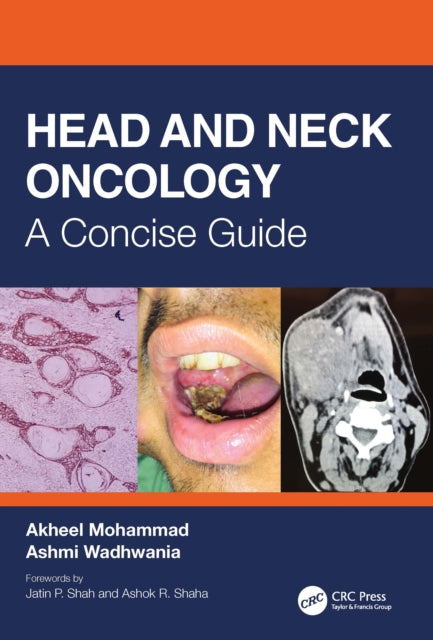 Binding: Paperback
Description: This concise handbook has a unique approach and covers all important aspects of head and neck cancers from basic topics like carcinogenesis to advanced treatment options such as immunotherapy electrochemotherapy and robotic surgery in a succinct way.