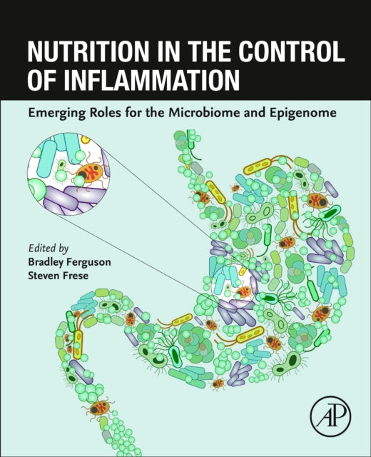 Binding: Paperback
Description: Nutrition in the Control of Inflammation: Emerging Roles for the Microbiome and Epigenome is a comprehensive guide that delves into the intricate relationship between diet and inflammation to regulate inflammatory diseases.