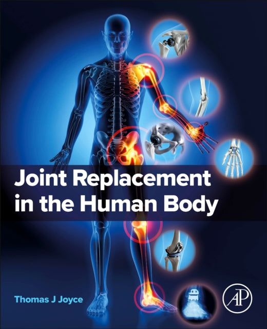 Binding: Paperback
Description: Joint Replacement in the Human Body provides a comprehensive exploration of artificial joint designs. The book's primary focus is to introduce readers to the diverse landscape of artificial joint technologies while offering insights into their historical development.