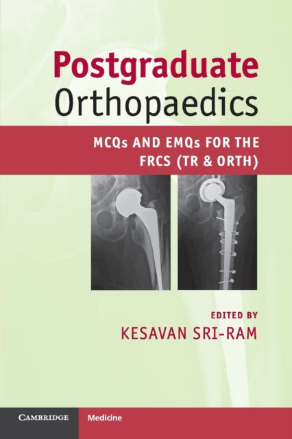 Binding: Paperback
Description: Practice is critical when preparing for any examination; the written component of the FRCS (Tr and Orth) is no exception. Written by surgeons with recent exam experience this book features both styles of exam questions and covers the syllabus topics.