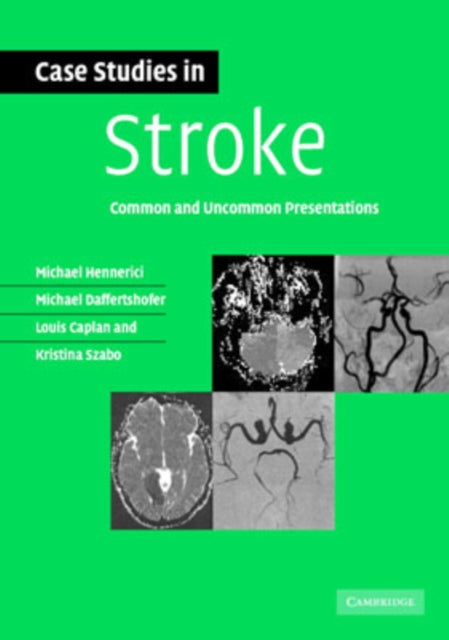 Binding: Paperback
Description: Neurologists learn from their patients and this selection of 60 stroke cases will inform and challenge clinicians at all stages in their careers.