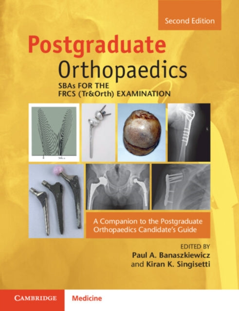 Binding: Paperback
Description: This newly revised edition contains high - quality orthopaedic exam questions using the single best answer format. Now containing updated topics and questions this useful text encourages higher order thinking and judgement.