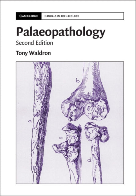 Binding: Paperback
Description: Palaeopathology is an evidence - based guide to the principal types of pathological lesions often found in human remains and how to diagnose them.