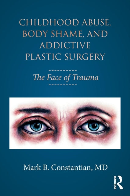 Binding: Paperback
Description: Childhood Abuse Body Shame and Addictive Plastic Surgery explores the psychopathology that plastic surgeons can encounter when seemingly excellent surgical candidates develop body dysmorphic disorder postoperatively.