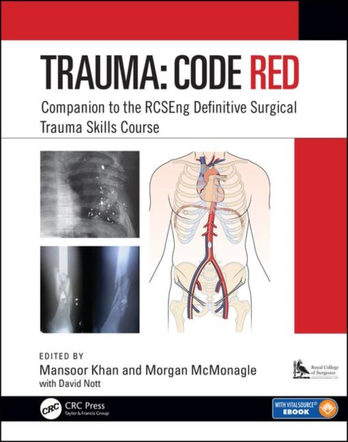 Binding: Paperback
Description: The Royal College of Surgeons of England two - day definitive surgical trauma skills course is run by the authors. The course began in 1997 but a new syllabus has recently been put in place.