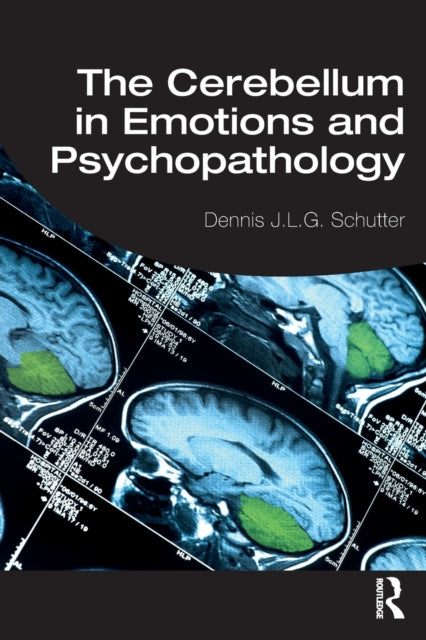 Binding: Paperback
Description: This groundbreaking volume examines the complex role of the cerebellum in emotional regulation and disorders that are insufficiently understood subverting the widely held belief that the cerebellum is solely involved in balance and motor functions.