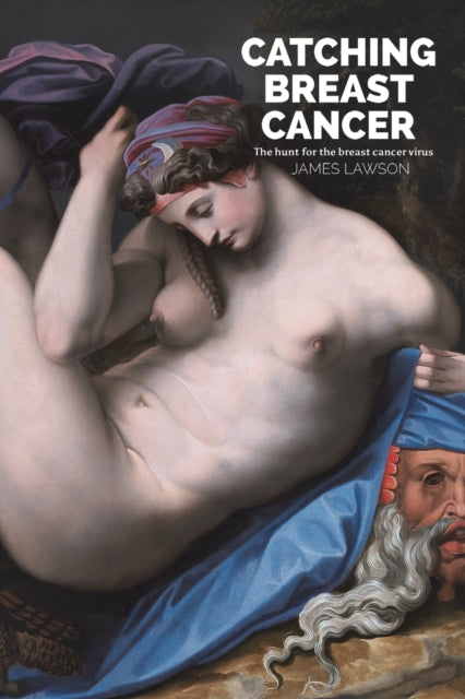Binding: Paperback
Title: Catching Breast Cancer The Hunt For The Breast Cancer Virus
Author(s): Lawson James
Publisher: Austin Macauley Publishers
Barcode: 9781398447820
Pages: 182 Pages, 0
Publication Date: 7/29/2022
Category: Diseases & Disorders