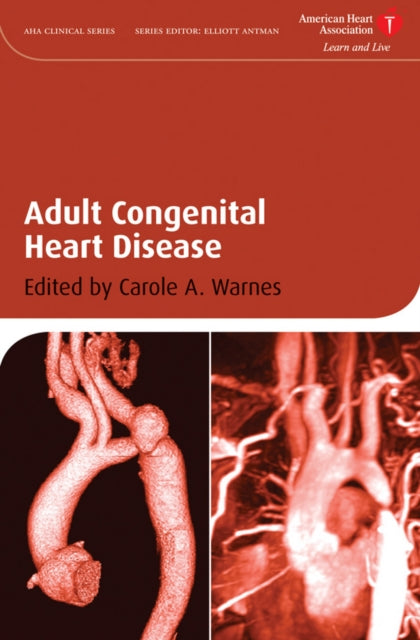 Binding: Hardcover
Description: This new reference guides physicians in the practical aspects of how to diagnose and treat patients with congenital heart disease.