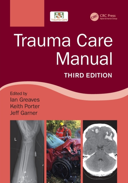 Taylor & Francis Inc - Trauma Care Manual - Paperback – Book Delivered