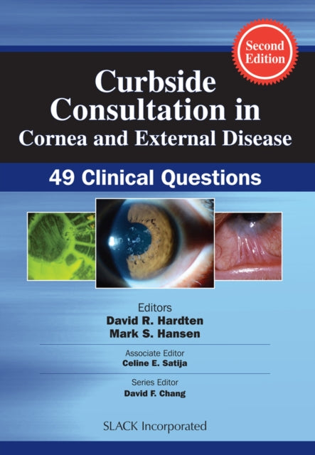 Binding: Paperback
Description: Curbside Consultation in Cornea and External Disease Second Edition contains new questions and brief practical evidence - based answers to the most frequently asked questions that are posed during a curbside consultation between clinicians. Dr. David R.