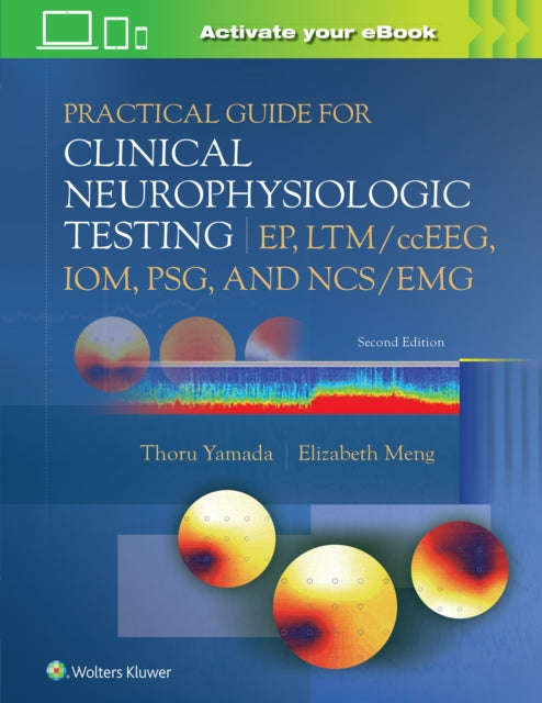 Meng Elizabeth - Practical Guide For Clinical Neurophysiologic Testing: Ep Ltm/ Cceeg Iom Psg And Ncs/ Emg - Paperback