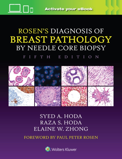 Binding: Hardcover
Description: Packed with sound solutions to common and uncommon diagnostic dilemmas Rosen's Diagnosis of Breast Pathology by Needle Core Biopsy Fifth Edition helps pathologists in the detection of subtle features which lead to decisive diagnoses. In this award - winning text Drs. Syed A.