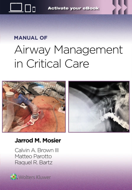 Binding: Paperback
Description: Patterned after the renowned Walls Manual of Emergency Airway Management Manual of Airway Management in Critical Care is a concise focused reference on this challenging topic specifically for ICU providers. Drs. Jarrod M. Mosier Calvin A. Brown III Matteo Parotto and Raquel R.